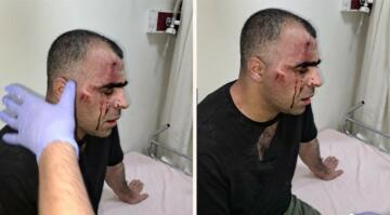 Yolsuzluk haberleri yapan Gazeteci Sinan Aygül Tatvan’da saldırıya uğradı